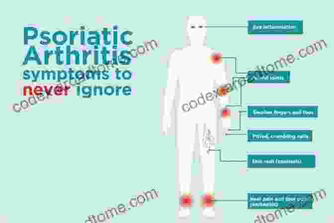 A Detailed Illustration Of The Symptoms And Pathology Of Psoriatic Arthritis Psoriatic Arthritis (Oxford Rheumatology Library)