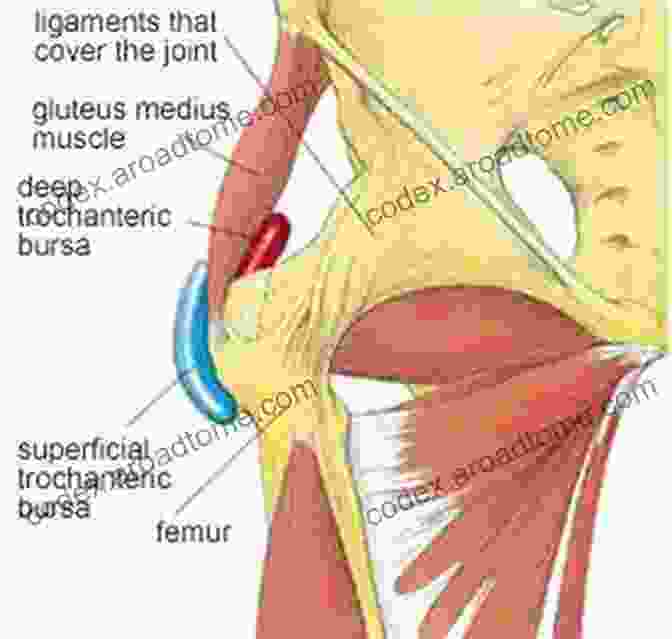 A Diagram Of The Hip Joint, Showing The Location Of The Trochanteric Bursa GOODBYE TO HIP (TROCHANTERIC) BURSITIS: The New Ultimate Guide On Healing Principle Physical Therapy Tips And Answers To Natural Hip Bursitis Joint Pain And Knee