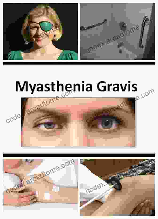 A Person With Myasthenia Gravis Receiving Treatment A Simple Guide To Myasthenia Gravis Treatment And Related Conditions (A Simple Guide To Medical Conditions)