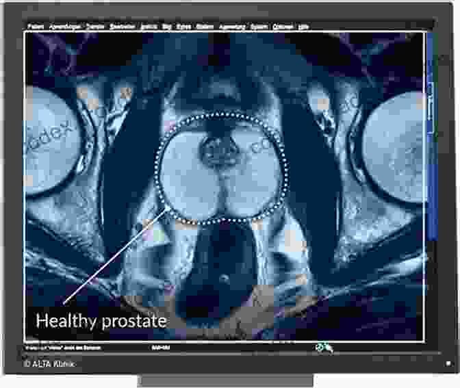 A Worried Looking Doctor Holding A Medical Scan Of A Prostate The LD Chronicles: A Story About A Physician And His Missing Prostate