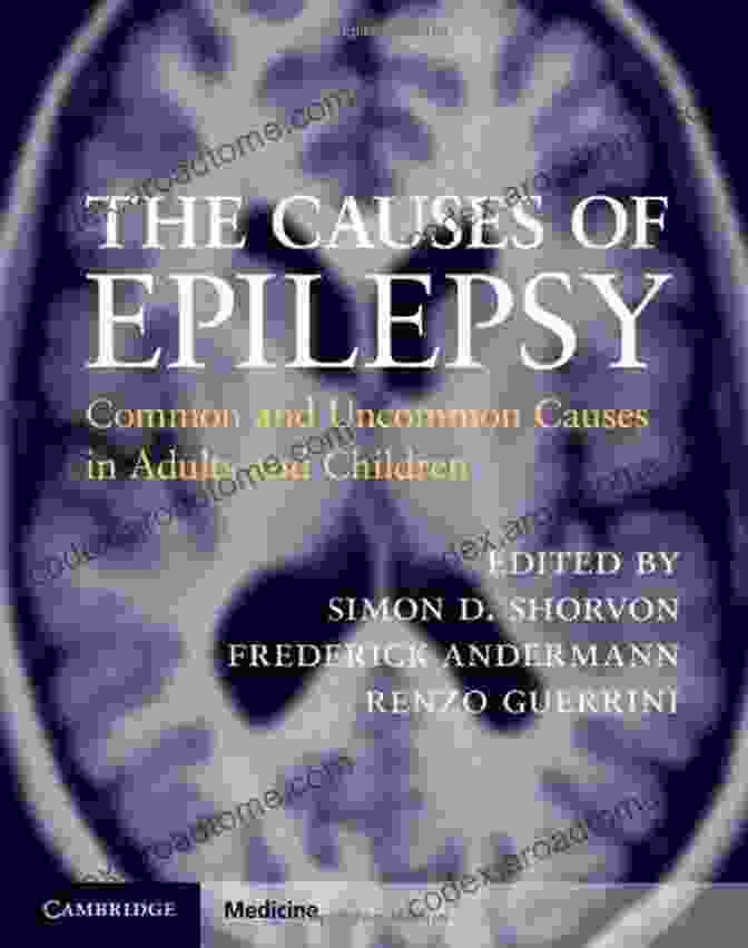 Common And Uncommon Causes In Adults And Children Cambridge Medicine Hardcover The Causes Of Epilepsy: Common And Uncommon Causes In Adults And Children (Cambridge Medicine (Hardcover))