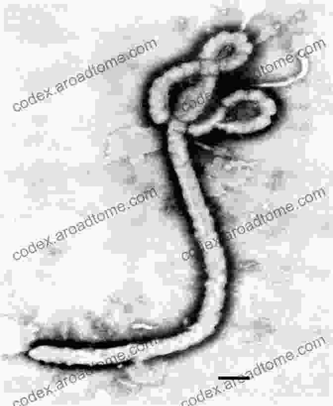 Electron Microscope Image Of The Ebola Virus The Hot Zone Carly Phillips