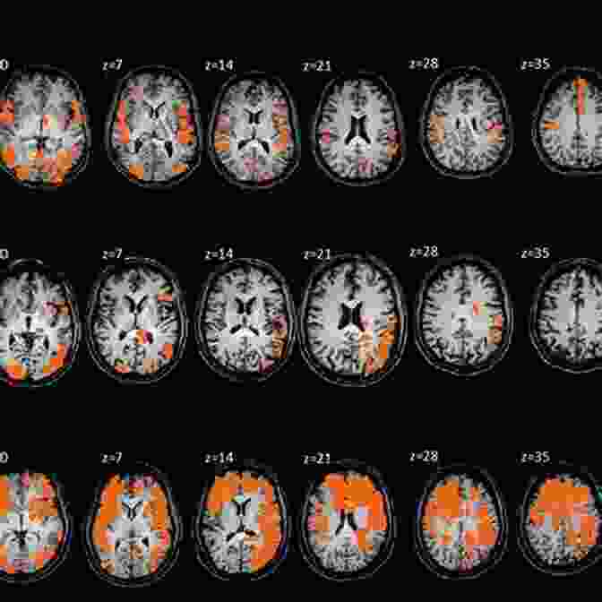 FMRI Brain Scan Showing Activation Patterns Associated With Subjective Experience In Consciousness We Trust: The Cognitive Neuroscience Of Subjective Experience