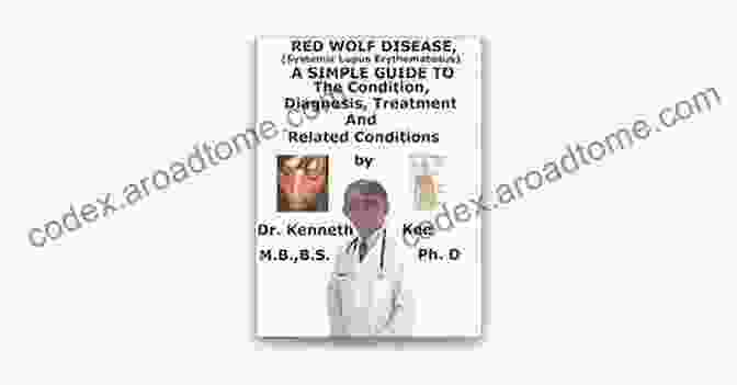 Red Wolf Disease (Systemic Lupus Erythematosus) A Simple Guide To Red Wolf Disease (Systemic Lupus Erythematosus) Diagnosis Treatment And Related Conditions