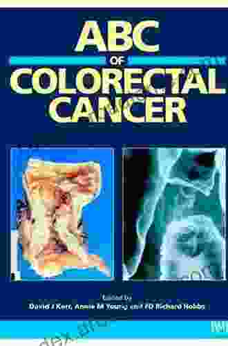 ABC Of Colorectal Cancer (ABC 188)