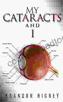 My Cataracts And I: Experiences With Cataract Removal From My Eyes As Complicated By Glaucoma