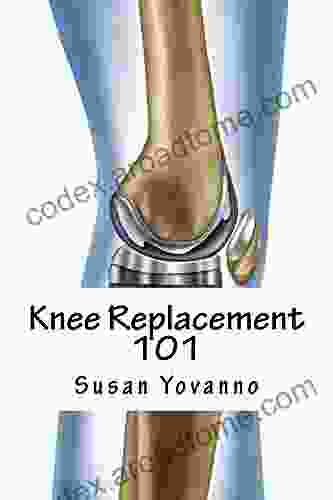 Knee Replacement 101 Richard Greene