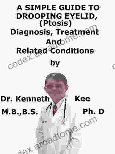 A Simple Guide To Drooping Eyelid (Ptosis) Diagnosis Treatment And Related Conditions