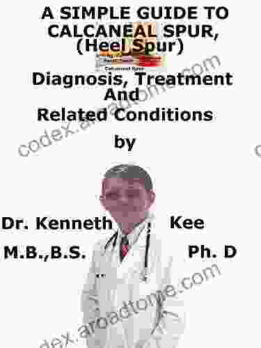 A Simple Guide To Calcaneal Spur (Heel Spur) Diagnosis Treatment And Related Conditions (A Simple Guide To Medical Conditions)