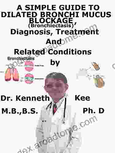 A Simple Guide To Dilated Bronchi Mucus Blockage (Bronchiectasis) Diagnosis Treatment And Related Conditions