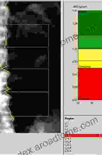 Quantitative Methods In Bone Densitometry