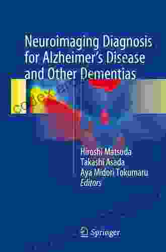 Neuroimaging Diagnosis For Alzheimer S Disease And Other Dementias